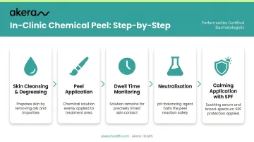 Five-step chemical peel in-clinic session process flow diagram