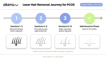 PCOS laser hair removal session progression timeline from initial to maintenance phase
