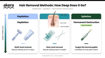 Three hair removal categories depilation epilation and permanent destruction comparison infographic