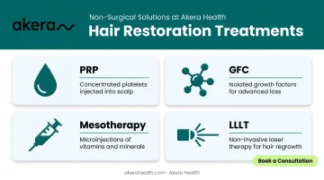 Four hair restoration treatment types PRP GFC mesotherapy and laser therapy comparison