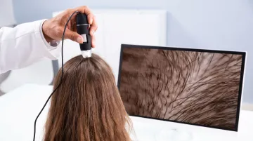 Patient consultation with dermatologist reviewing hair loss assessment and trichoscopy results
