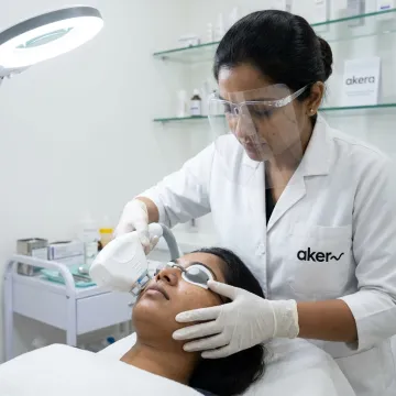 Laser freckle removal treatment in a dermatology clinic