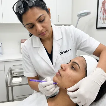 Dermatologist planning jawline filler treatment