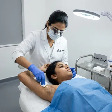 Underarm chemical peel treatment in dermatology clinic