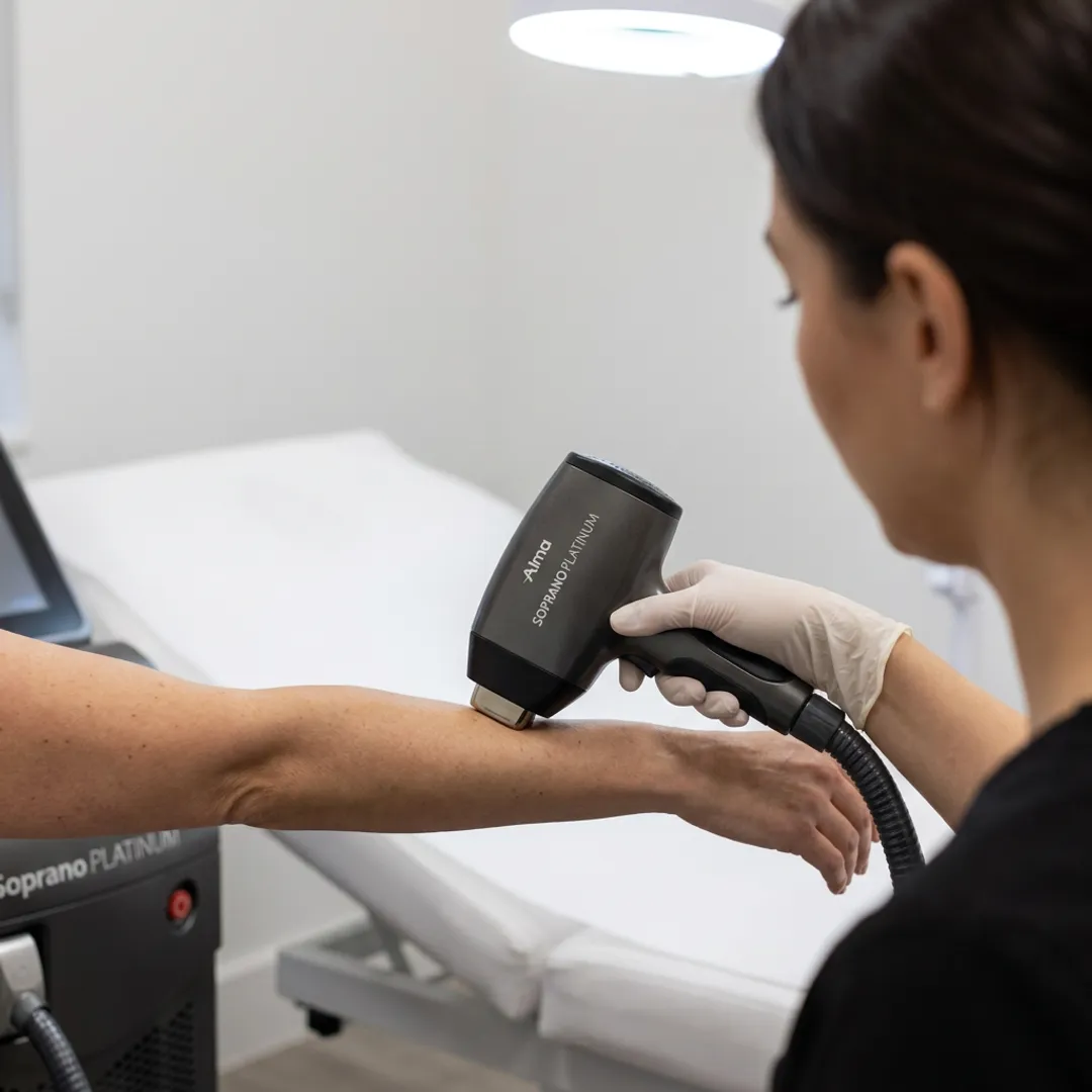 Soprano Platinum Laser Hair Removal Systems