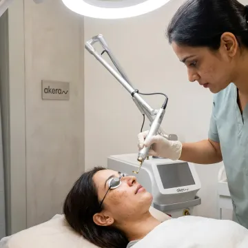 Dermatologist preparing laser freckle removal treatment
