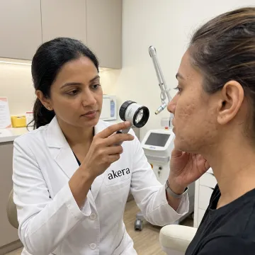 Dermatologist assessing facial acne scars