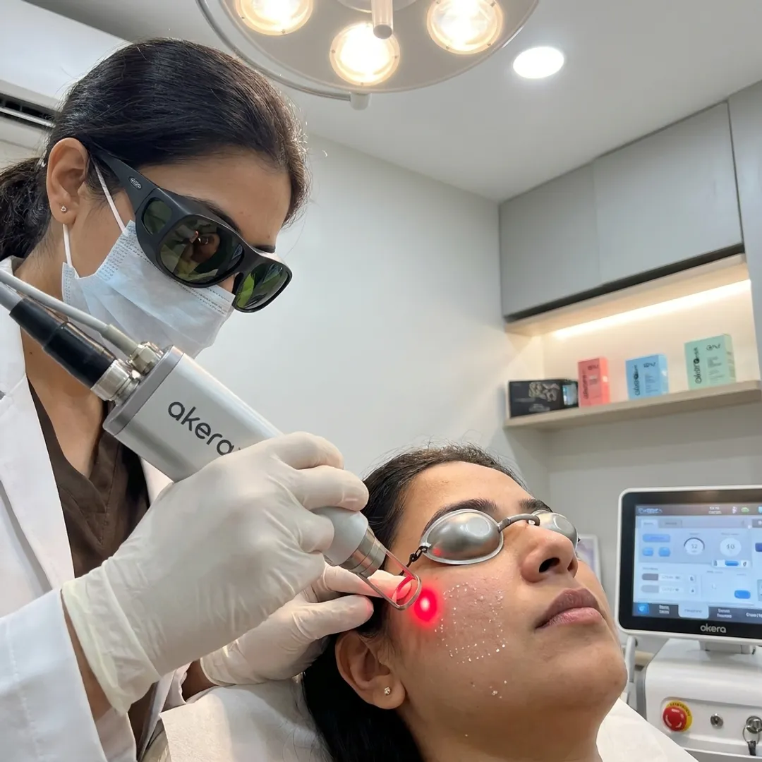 Laser Facial Treatment & Resurfacing Services