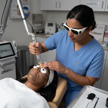 Carbon Laser Treatment Cost in Bangalore