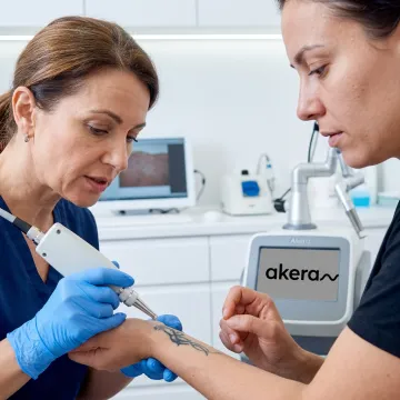 Dermatologist assessing tattoo before laser removal