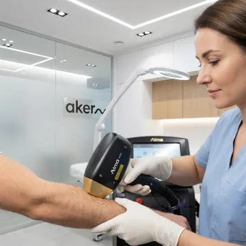 Laser Hair Removal for Men