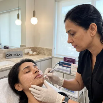 Chin and Jawline Filler in Bangalore