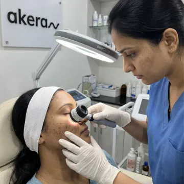 Dermatologist assessing facial pigmentation before laser treatment