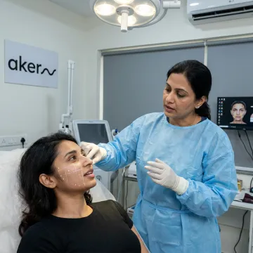 Cheek Fillers In Bangalore