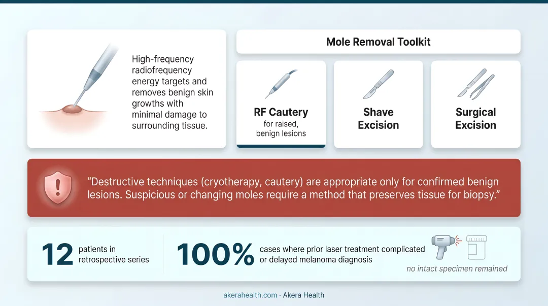 Four professional mole removal methods comparison chart shave excision to cryotherapy