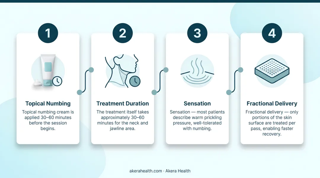 Morpheus8 neck treatment four-step on-the-day process flow infographic