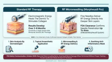 Four-step Morpheus8 Pro RF microneedling treatment protocol process flow