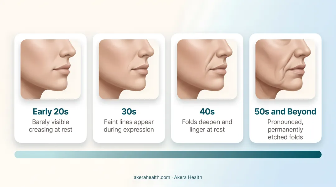 Nasolabial fold progression timeline across four age ranges infographic