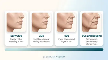 Nasolabial fold progression timeline across four age ranges infographic