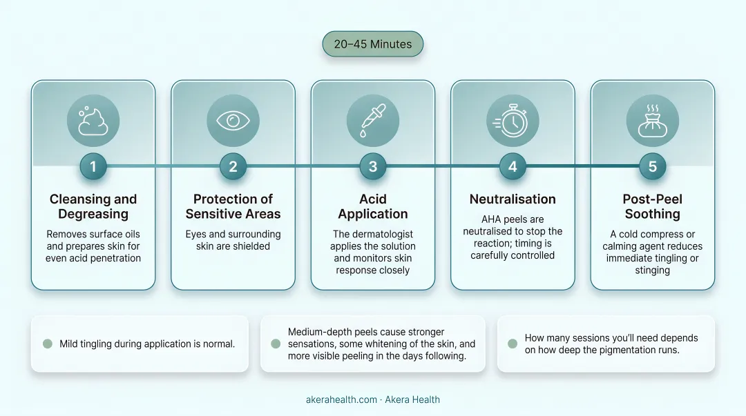 5-step chemical peel in-clinic procedure process flow diagram