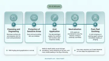 5-step chemical peel in-clinic procedure process flow diagram