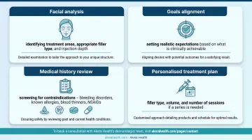 Four-step dermal filler consultation process infographic from facial analysis to treatment plan