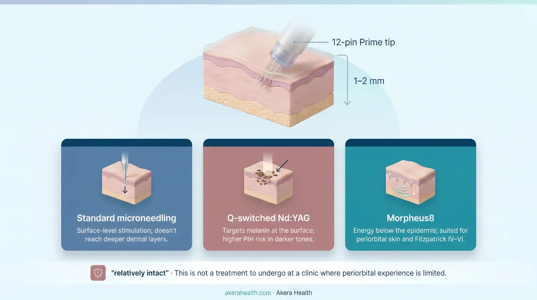 Morpheus8 versus microneedling versus laser treatment three-way comparison infographic