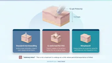 Morpheus8 versus microneedling versus laser treatment three-way comparison infographic