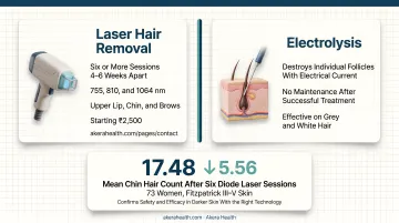 Laser hair removal process timeline showing six sessions spaced over menopausal facial hair treatment