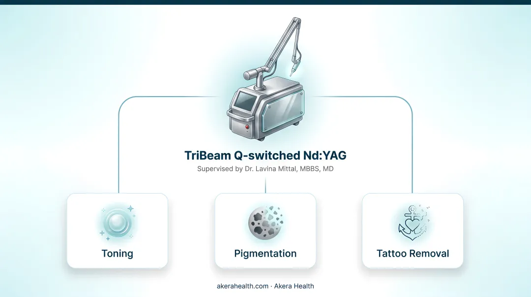 Nd:YAG laser treatment conditions and operating modes versatility chart