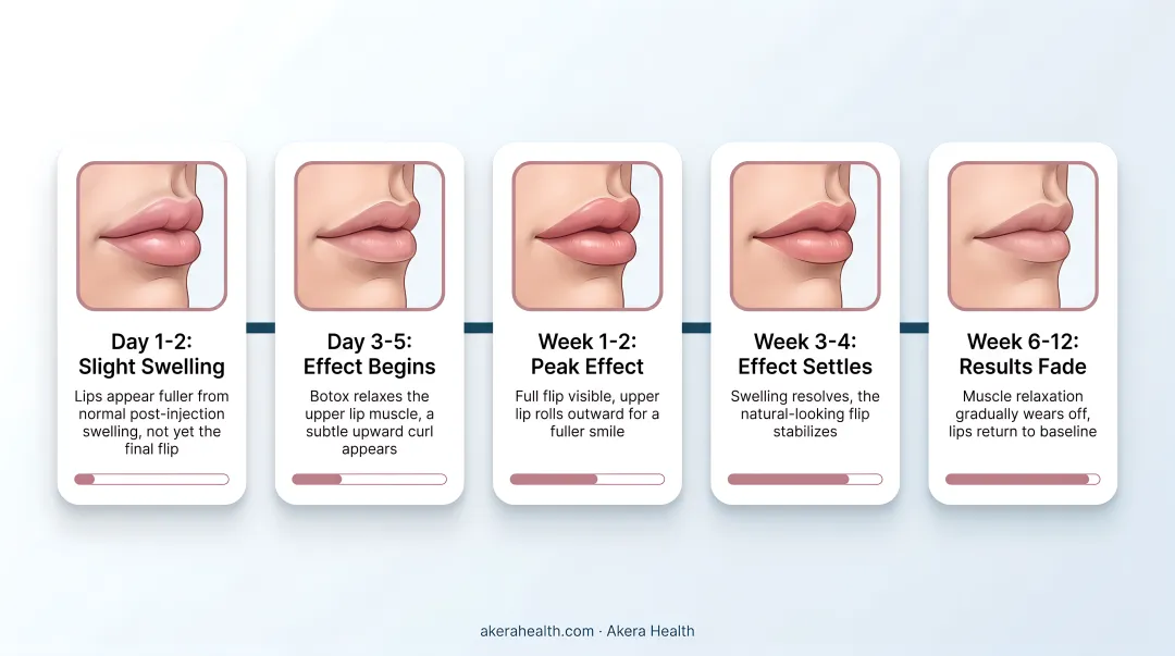 Botox lip flip week-by-week results timeline from day one to week six