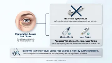 Morpheus8 under-eye limitations table with four concerns and better treatment alternatives