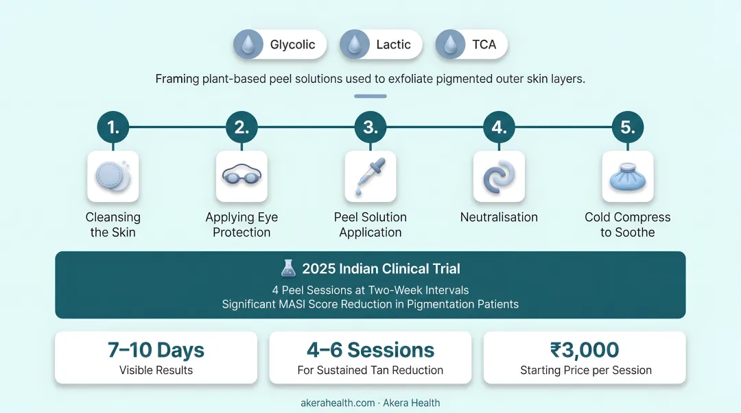 Five-step dermatologist chemical peel protocol infographic for tan removal
