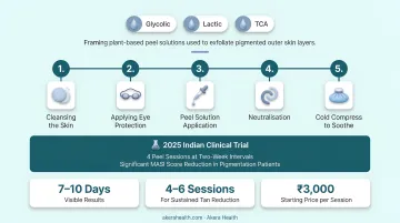Five-step dermatologist chemical peel protocol infographic for tan removal