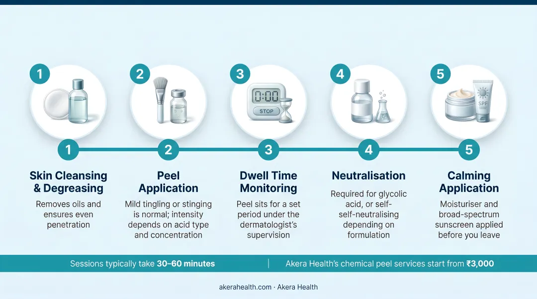 Five-step chemical peel in-clinic session process flow diagram