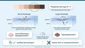 Fitzpatrick skin type IV–V Q-switched 1064nm wavelength safety advantages explained