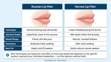 Russian lip filler versus normal lip filler five-feature side-by-side comparison chart