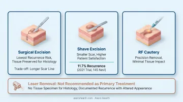 Three facial mole removal methods surgical shave excision and RF cautery comparison
