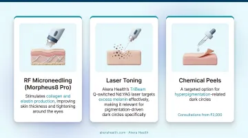 Akera Health clinic treatment options for under-eye rejuvenation RF microneedling laser