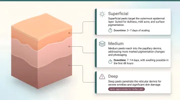 Three chemical peel depth levels comparison superficial medium and deep skin layers