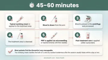 Six-step PRP facial procedure sequence from numbing cream to post-treatment care