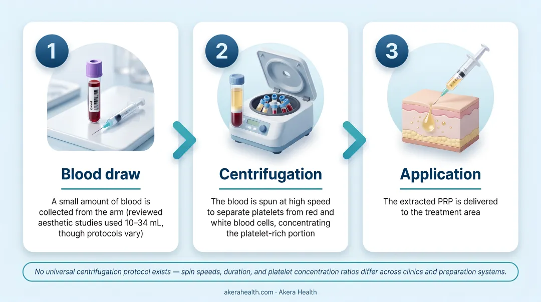 Three-step PRP preparation process blood draw centrifugation and application