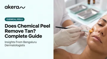 Does Chemical Peel Remove Tan? Complete Guide