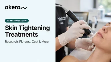 Skin Tightening Treatments: Research, Pictures, Cost &amp; More