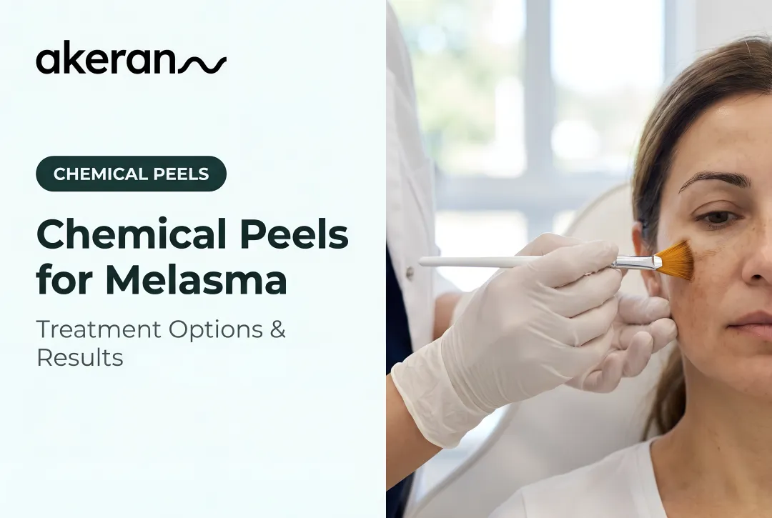 Chemical Peels for Melasma: Treatment Options & Results
