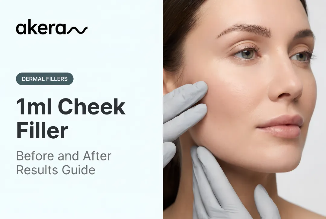 1ml Cheek Filler: Before and After Results Guide