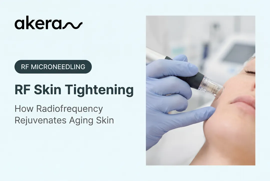 RF Skin Tightening: How Radiofrequency Rejuvenates Aging Skin