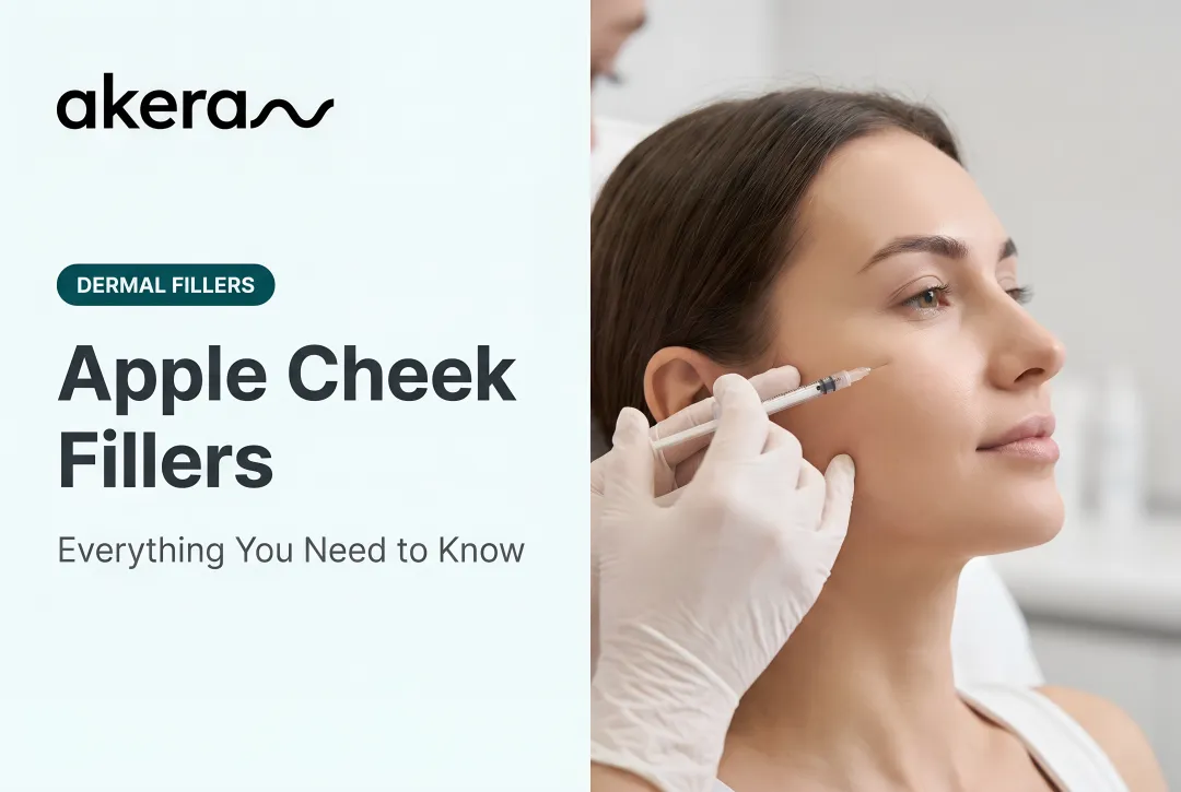 Apple Cheek Fillers: Everything You Need to Know