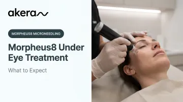 Morpheus8 Under Eye Treatment: What to Expect
