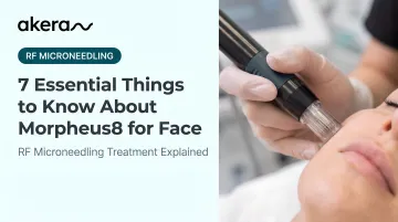 7 Essential Things to Know About Morpheus8 for Face